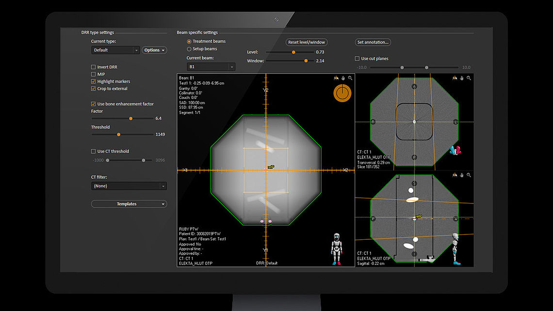 LINAC QA DRR generation using RayStation treatment planning system