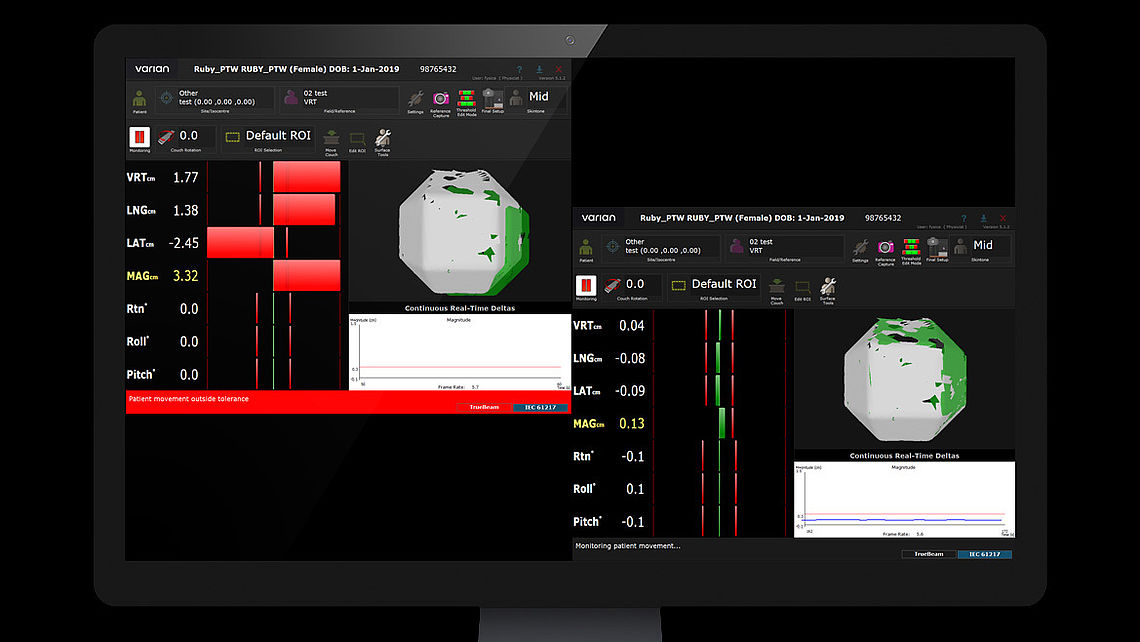 LINAC QA Table alignment checks using VARIAN OSMS: Left: RUBY with LINAC QA insert is setup on patient couch with defined offset (grey line). Misalignment (translation) is detected by OSMS. Right: RUBY after CBCT imaging and needed table shift – phantom position matches reference data set.