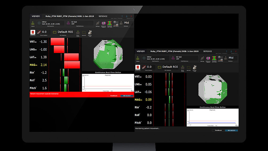 LINAC QA Table alignment checks using VARIAN OSMS: Left: RUBY with LINAC QA insert and tiling base is set up on patient couch with defined offset (red line). Misalignment (translation/rotation) is detected by OSMS. Right: RUBY after CBCT imaging and needed table shift and rotation – phantom position matches reference data set.