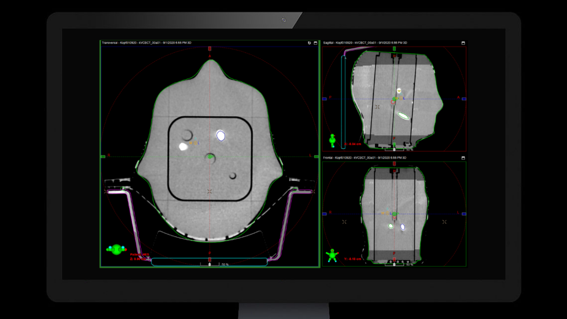RUBY head phantom: CBCT imaging on Varian Truebeam system of RUBY head phantom with System QA MultiMet insert.