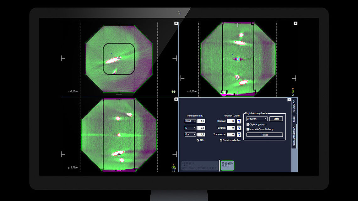 LINAC QA Fusion of RUBY CBCT and planning CT images (without tilting base): System detects misalignment.