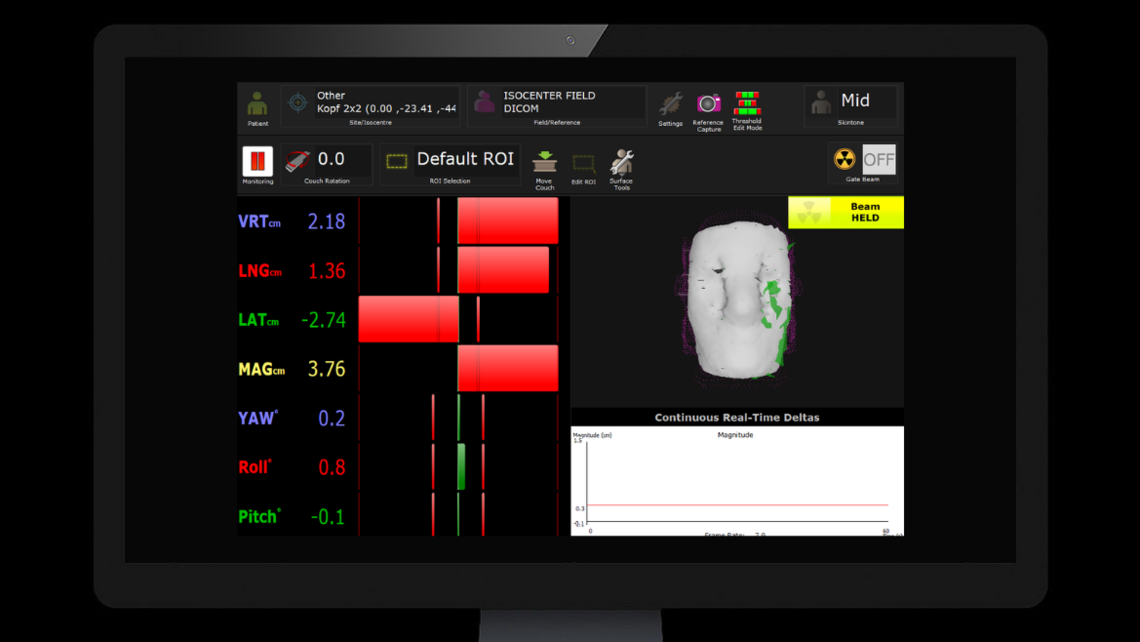 RUBY head phantom: Monitored by Vision-RT surface guided system, misaligned