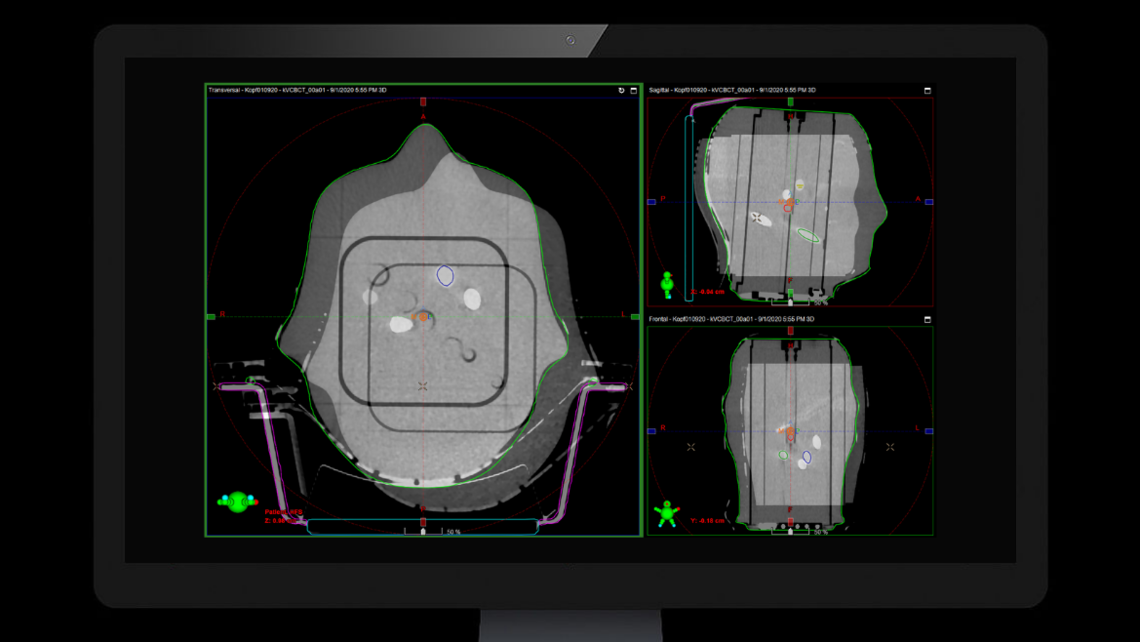 RUBY head phantom: CBCT imaging on Varian Truebeam system of RUBY head phantom with System QA MultiMet insert.