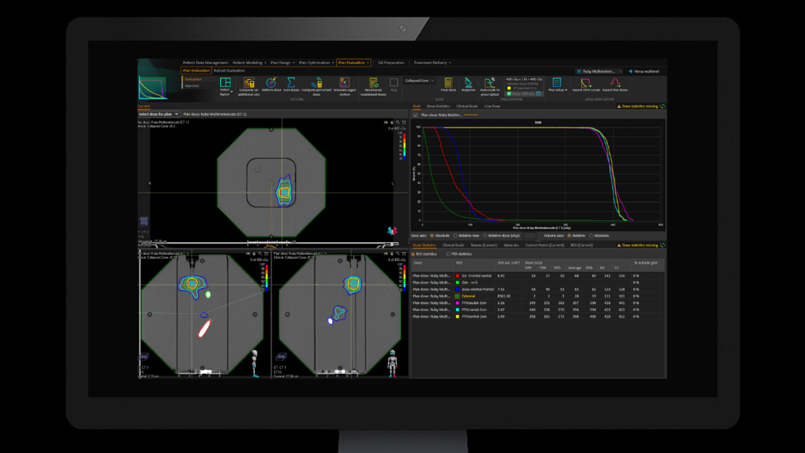 Multiple metastasis applications: Single isocenter treatment plan irradiating three target volumes. Target volumes are contoured at the detector positions. Isocenter is placed at the center of the phantom.